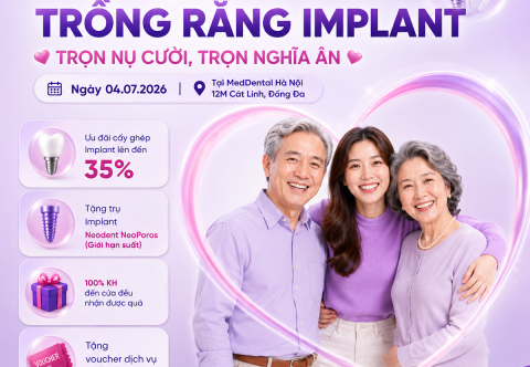Tháng Vàng Trồng Răng Implant 